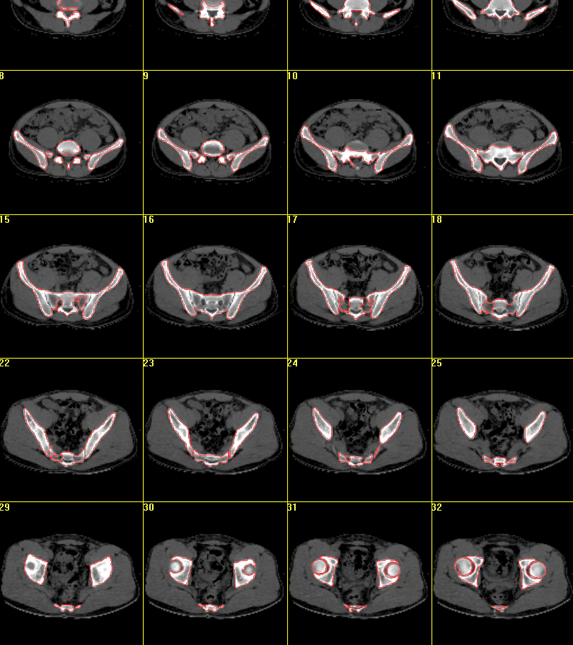 Figure 11. An example of a series of images.