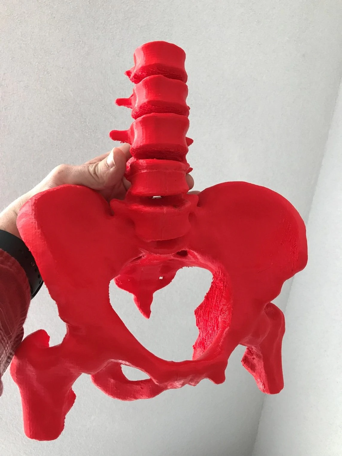 Figure 13. Our 3D model of a pelvis.
